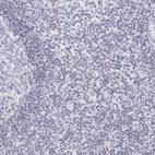 Anti-XPNPEP2 Antibody