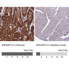 Anti-ARHGAP12 Antibody