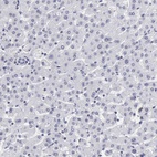Anti-CSTF2 Antibody