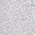 Anti-CCNB3 Antibody