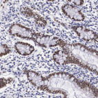 Anti-HMGN5 Antibody