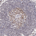Anti-CCDC117 Antibody