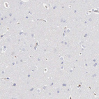 Anti-SERPINA1 Antibody