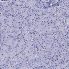 Anti-GLA Antibody
