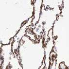 Anti-AOC3 Antibody