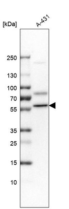 Anti-DKC1 Antibody