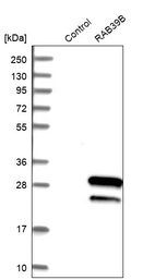 Anti-RAB39B Antibody