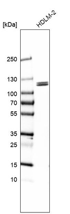 Anti-PPP4R3B Antibody