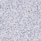 Anti-RPS6KA5 Antibody