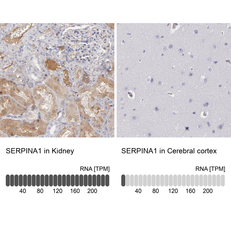 Anti-SERPINA1 Antibody