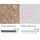 Anti-ATP2B3 Antibody