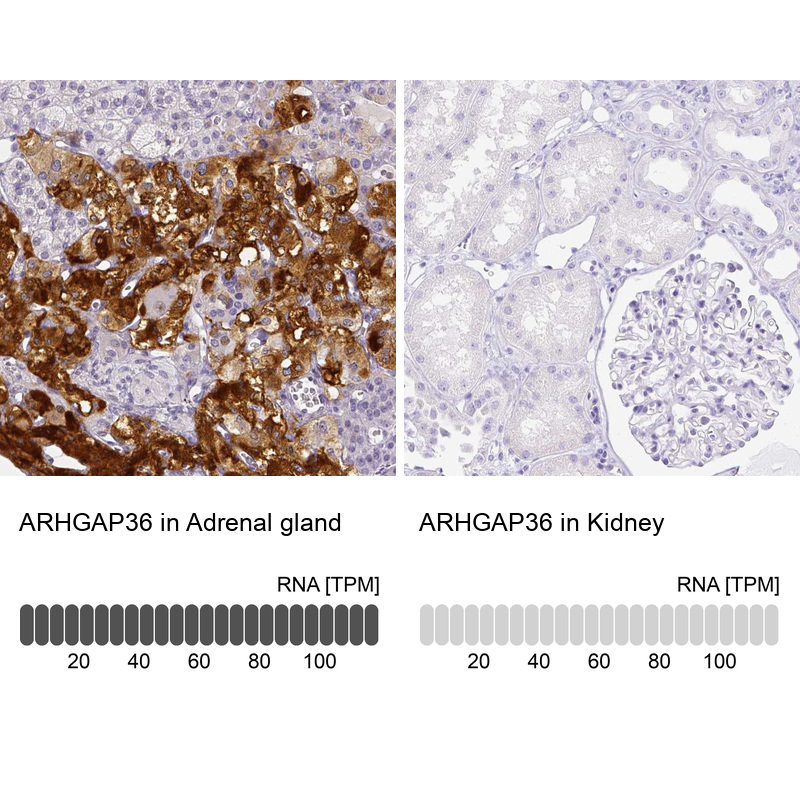 Anti-ARHGAP36 Antibody