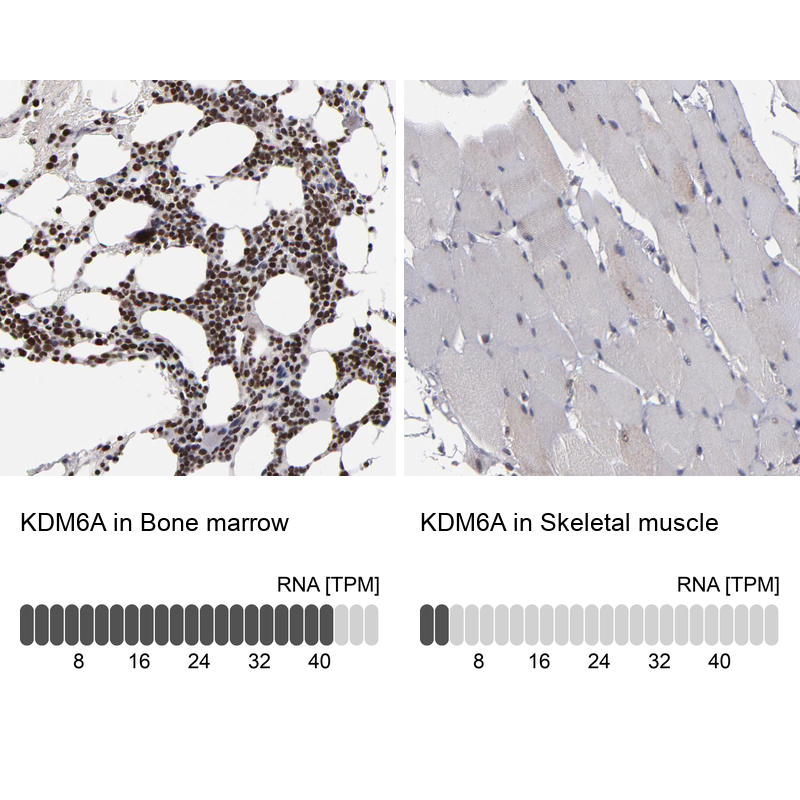 Anti-KDM6A Antibody