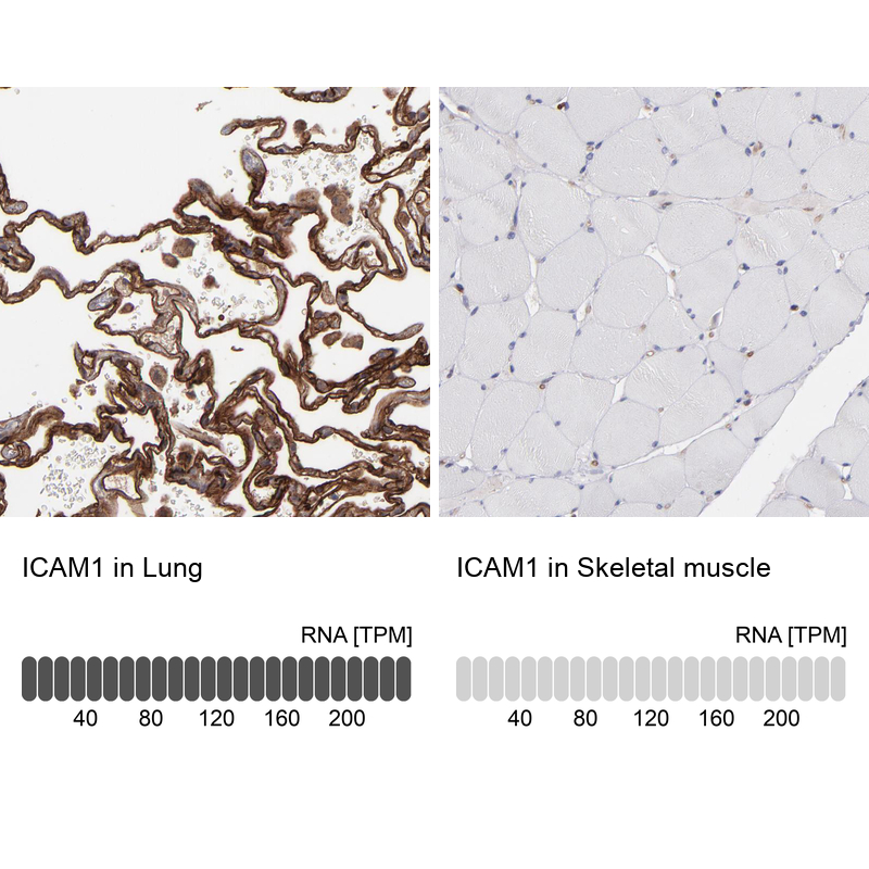 Anti-ICAM1 Antibody