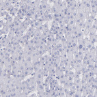 Anti-IRF8 Antibody