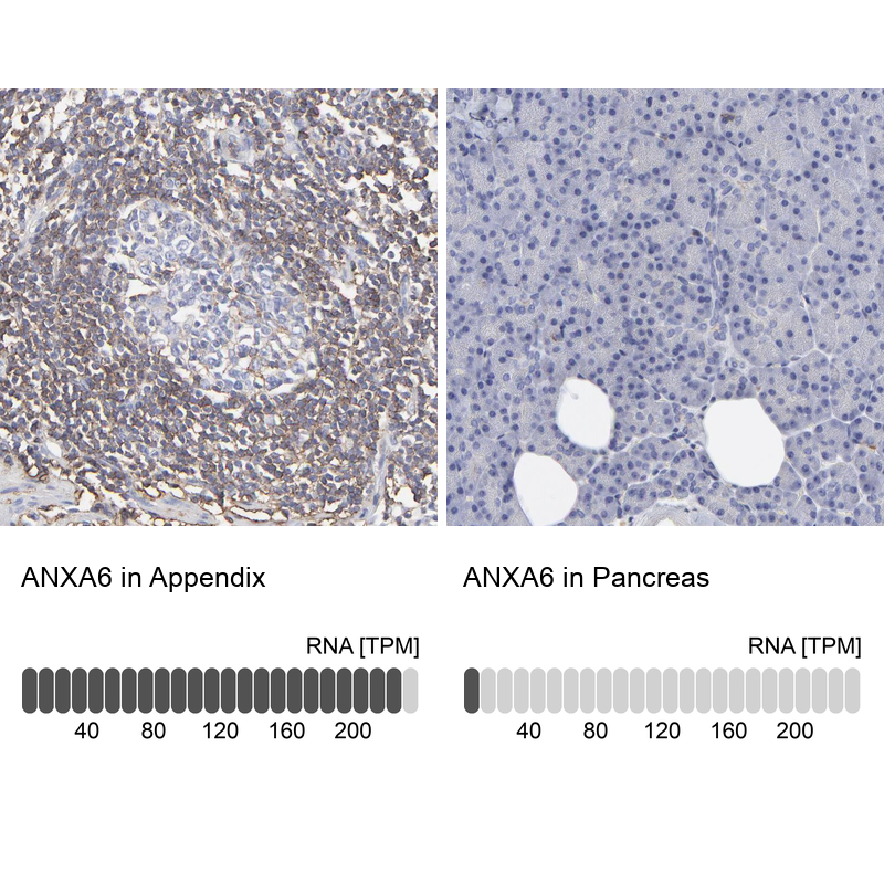 Anti-ANXA6 Antibody