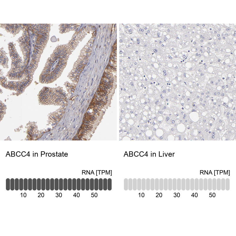 Anti-ABCC4 Antibody