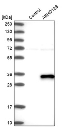 Anti-ABHD12B Antibody