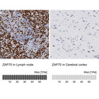 Anti-ZAP70 Antibody