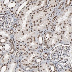 Anti-RPS6KA3 Antibody