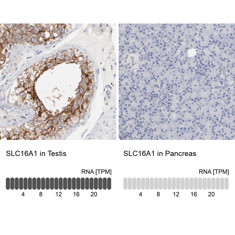 Anti-SLC16A1 Antibody