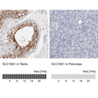 Anti-SLC16A1 Antibody
