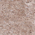 Anti-SLC16A2 Antibody