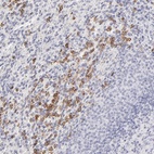 Anti-LTB4R Antibody