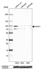 Anti-FOXP1 Antibody