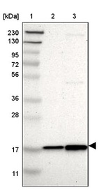Anti-UBE2I Antibody
