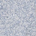 Anti-BCL6 Antibody