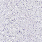Anti-CXorf67 Antibody