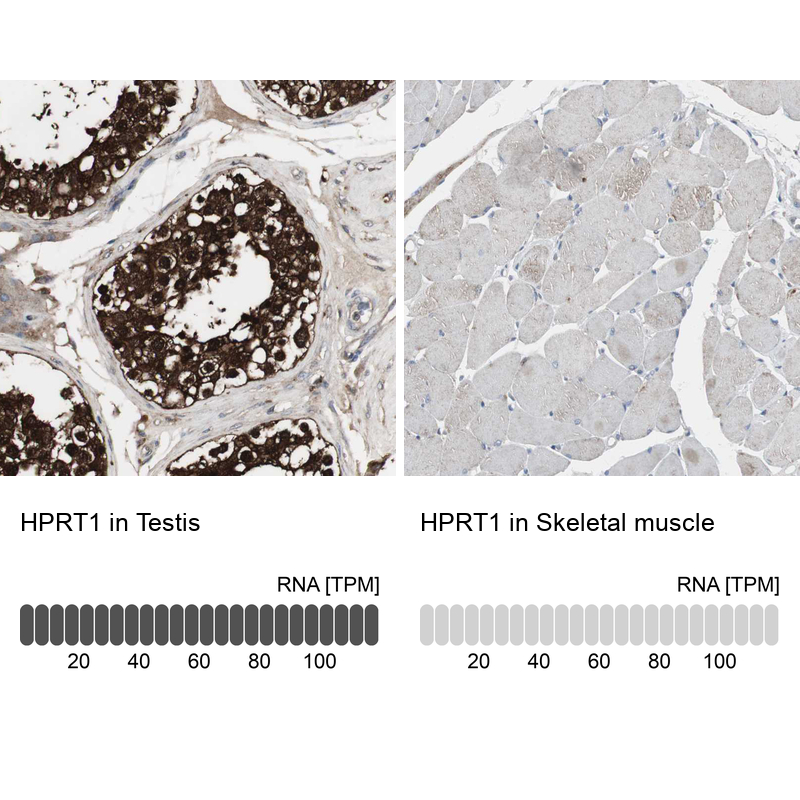 Anti-HPRT1 Antibody