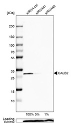 Anti-CALB2 Antibody