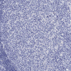 Anti-GPR61 Antibody