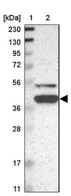 Anti-KLHDC8B Antibody