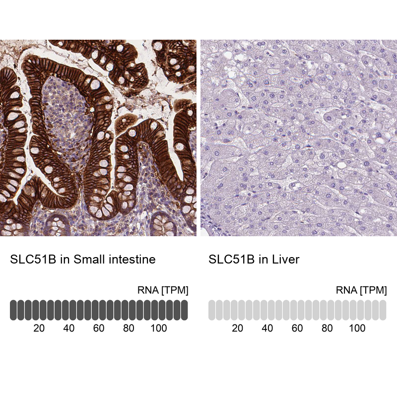 Anti-SLC51B Antibody
