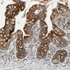 Anti-MRPL9 Antibody