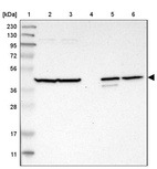 Anti-C1orf159 Antibody