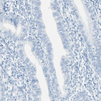 Anti-CYSLTR1 Antibody