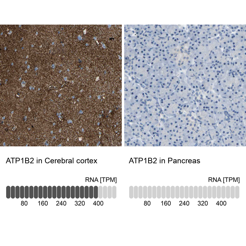 Anti-ATP1B2 Antibody