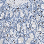 Anti-CEACAM1 Antibody