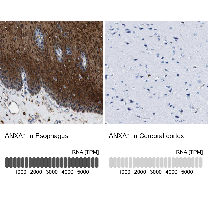 Anti-ANXA1 Antibody