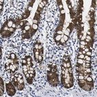 Anti-CASP6 Antibody
