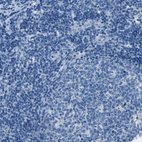 Anti-ACSL1 Antibody