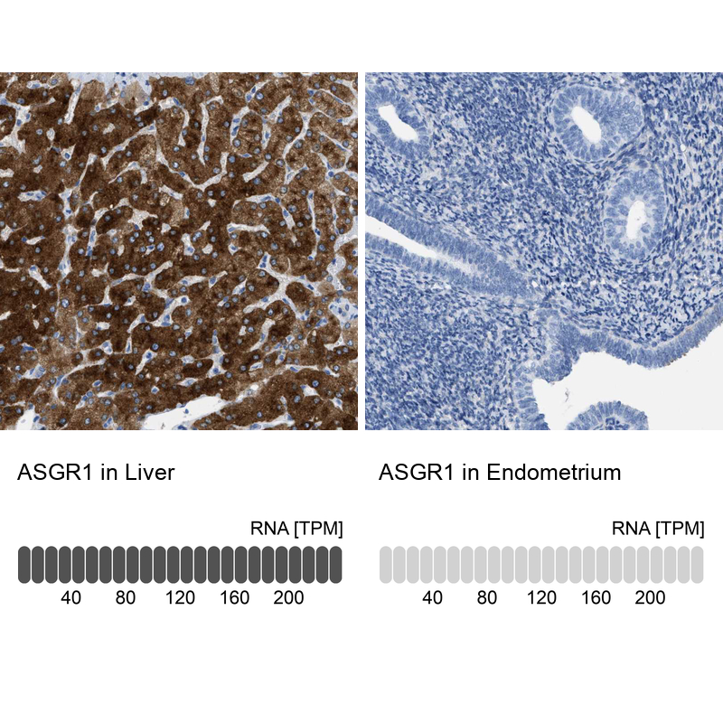 Anti-ASGR1 Antibody
