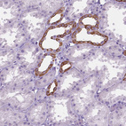Anti-HTR2B Antibody