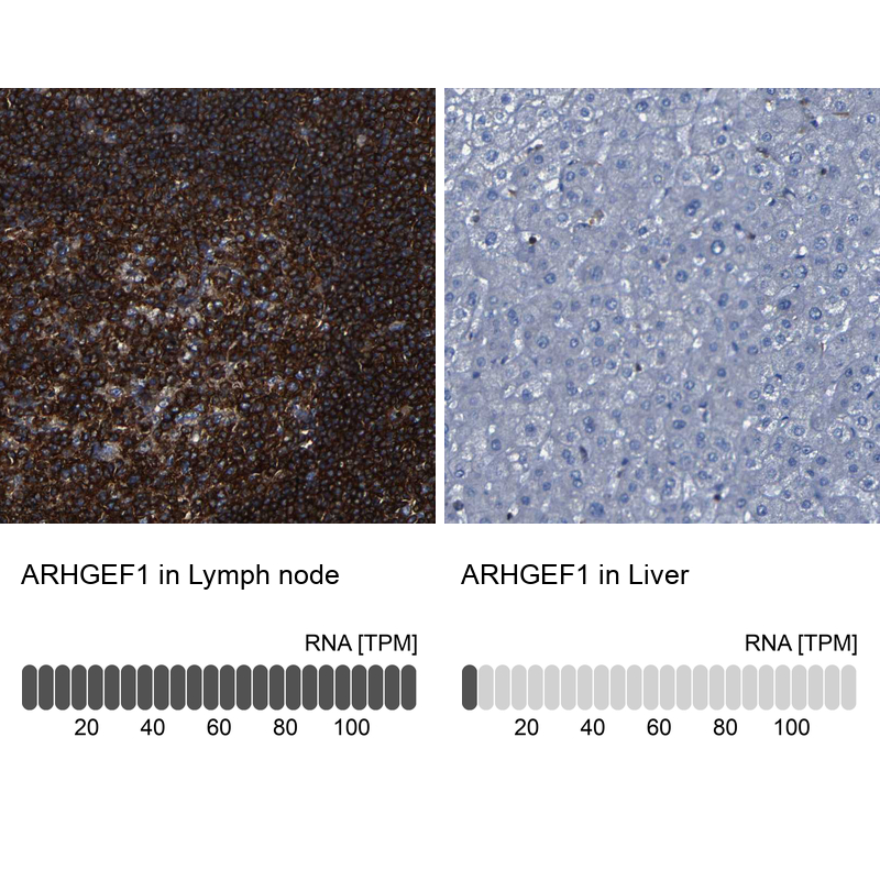 Anti-ARHGEF1 Antibody