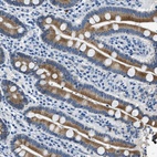 Anti-UBAC2 Antibody
