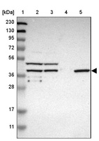 Anti-SLC22A23 Antibody